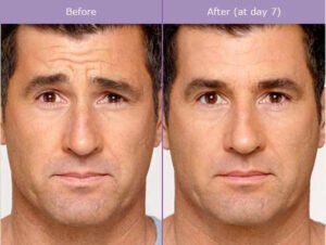 globaleliteesthetician